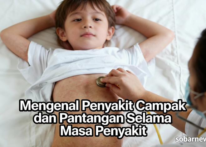 Mengenal Penyakit Campak dan Pantangan Selama sakit campak